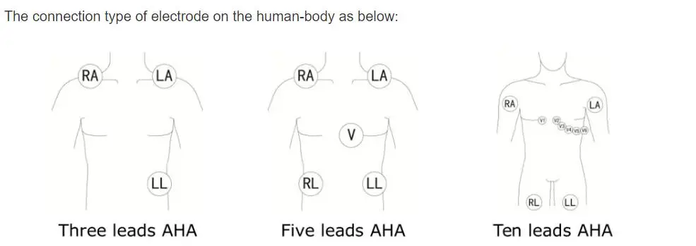 Dây dẫn ECG 5 đầu cho philips Digitrak cộng với 24 giờ holter 3100A, 5 chì, Snap